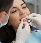 Porcelain Veneer Smile Mock-up Simulation in Chengdu